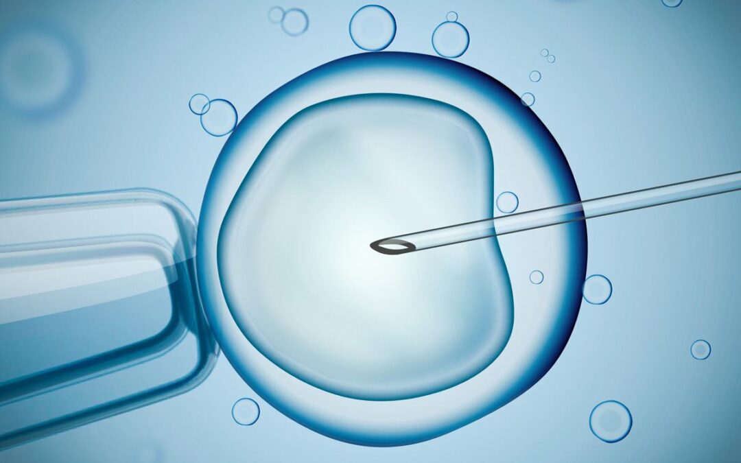 In-vitro-Fertilisation (IVF)